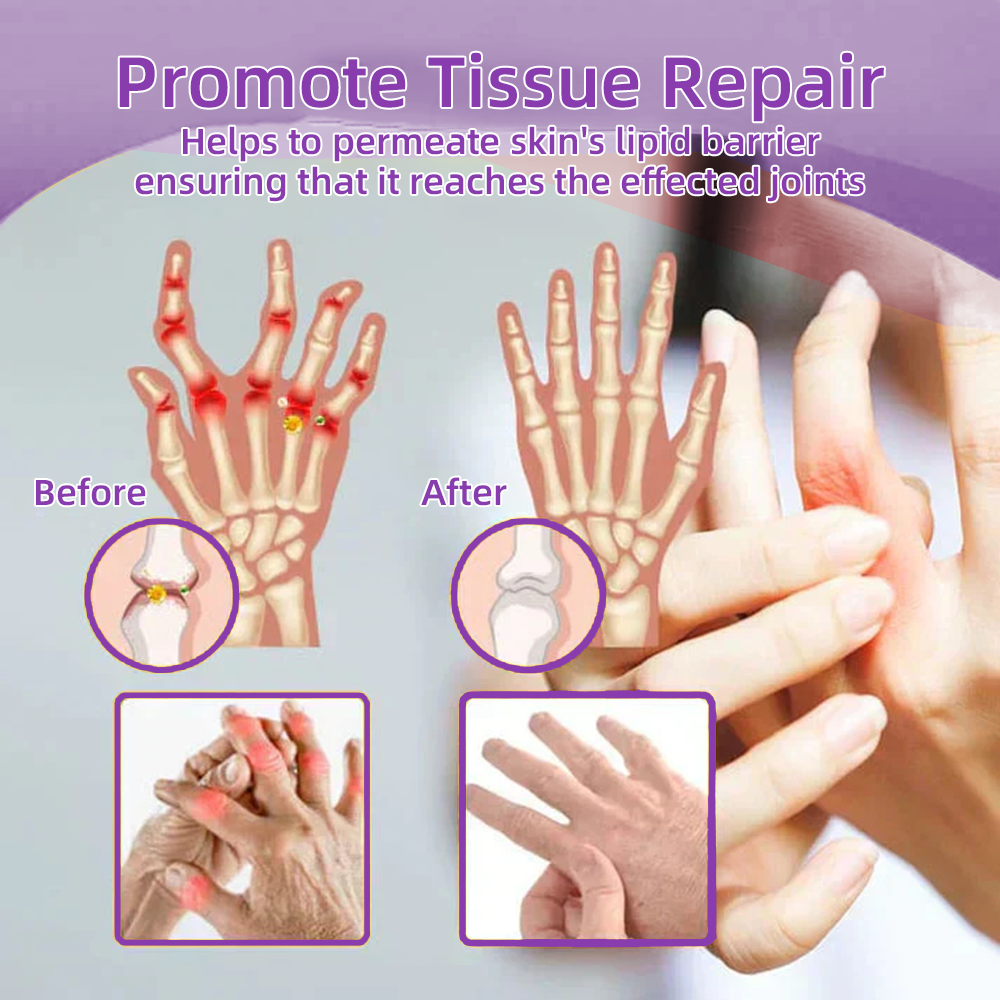 𝐎𝐟𝐟𝐢𝐜𝐢𝐚𝐥 𝐒𝐭𝐨𝐫𝐞: Trilumia® 𝑺𝒉𝒂𝒓𝒌 𝑪𝒂𝒓𝒕𝒊𝒍𝒂𝒈𝒆 𝑷𝒂𝒊𝒏-𝑺𝒐𝒐𝒕𝒉𝒊𝒏𝒈 𝑩𝒐𝒏𝒆 𝑹𝒆𝒄𝒐𝒗𝒆𝒓𝒚 𝑮𝒆𝒍 👨‍⚕️𝑨𝒎𝒆𝒓𝒊𝒄𝒂𝒏 𝑨𝒄𝒂𝒅𝒆𝒎𝒚 𝒐𝒇 𝑶𝒓𝒕𝒉𝒐𝒑𝒂𝒆𝒅𝒊𝒄 𝑺𝒖𝒓𝒈𝒆𝒐𝒏𝒔 (𝑨𝑨𝑶𝑺) 𝒓𝒆𝒄𝒐𝒎𝒎𝒆𝒏𝒅 (5-𝗆𝗂𝗇𝗎𝗍𝖾 𝗉𝖺𝗂𝗇 𝗋𝖾𝗅𝗂𝖾𝖿, 𝟩 𝖽𝖺𝗒𝗌 𝗍𝗈 𝗋𝖾𝗌𝗍𝗈𝗋𝖾 𝗃𝗈𝗂𝗇𝗍 𝗆𝗈𝖻𝗂𝗅𝗂𝗍𝗒, 𝟦 𝗐𝖾𝖾𝗄𝗌 𝖿𝗈𝗋 𝖼𝗈𝗆𝗉𝗅𝖾𝗍𝖾 𝗁𝖾𝖺𝗅𝗂𝗇𝗀)🔥