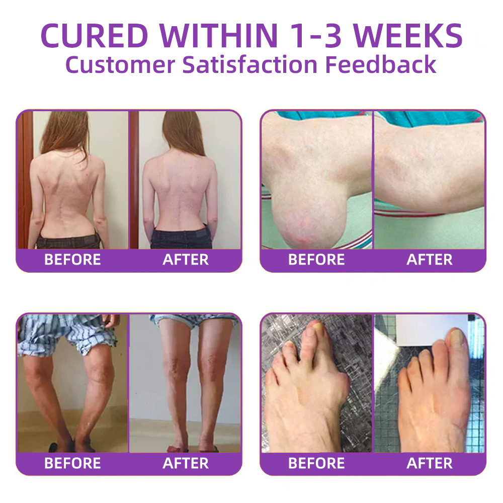𝐎𝐟𝐟𝐢𝐜𝐢𝐚𝐥 𝐒𝐭𝐨𝐫𝐞: Trilumia® 𝑺𝒉𝒂𝒓𝒌 𝑪𝒂𝒓𝒕𝒊𝒍𝒂𝒈𝒆 𝑷𝒂𝒊𝒏-𝑺𝒐𝒐𝒕𝒉𝒊𝒏𝒈 𝑩𝒐𝒏𝒆 𝑹𝒆𝒄𝒐𝒗𝒆𝒓𝒚 𝑮𝒆𝒍 👨‍⚕️𝑨𝒎𝒆𝒓𝒊𝒄𝒂𝒏 𝑨𝒄𝒂𝒅𝒆𝒎𝒚 𝒐𝒇 𝑶𝒓𝒕𝒉𝒐𝒑𝒂𝒆𝒅𝒊𝒄 𝑺𝒖𝒓𝒈𝒆𝒐𝒏𝒔 (𝑨𝑨𝑶𝑺) 𝒓𝒆𝒄𝒐𝒎𝒎𝒆𝒏𝒅 (5-𝗆𝗂𝗇𝗎𝗍𝖾 𝗉𝖺𝗂𝗇 𝗋𝖾𝗅𝗂𝖾𝖿, 𝟩 𝖽𝖺𝗒𝗌 𝗍𝗈 𝗋𝖾𝗌𝗍𝗈𝗋𝖾 𝗃𝗈𝗂𝗇𝗍 𝗆𝗈𝖻𝗂𝗅𝗂𝗍𝗒, 𝟦 𝗐𝖾𝖾𝗄𝗌 𝖿𝗈𝗋 𝖼𝗈𝗆𝗉𝗅𝖾𝗍𝖾 𝗁𝖾𝖺𝗅𝗂𝗇𝗀)🔥