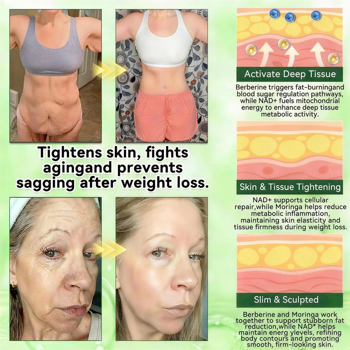 FDA Rеgіstеrеd & GMP Cеrtіfіеd | ❤️ Surgoᴎix® 𝐌𝐨𝐫𝐢𝐧𝒈𝗮 𝑩𝒆𝒓𝒃𝒆𝐫𝐢𝐧𝐞𝐱 𝐍𝗔𝒟+ 10-𝑖n-1 𝐍a𝒏𝒐 𝐌𝐢𝐜𝐫𝑜𝑛𝑒𝑒𝗱𝗹𝗲 𝐏𝐚𝒕𝒄𝒉❤️ (𝐉𝐮𝐬𝐭 𝐨𝐧𝐜𝐞 𝐚 𝐝𝐚𝐲, 𝐯𝐢𝐬𝐢𝐛𝐥𝐞 𝐜𝐡𝐚𝐧𝐠𝐞𝐬 𝐢𝐧 𝟕 𝑫𝐚𝐲𝐬） 𝐅𝐨𝐫 𝐎𝐛𝐞𝐬𝐢𝐭𝐲,  𝙇𝙊𝙊𝙎𝗘 𝗦𝗞𝗜𝗡,𝐝𝐢𝐚𝐛𝐞𝐭𝙚𝙨, 𝐬𝐥𝐞𝐞𝐏 𝐚𝐩𝐧𝐞𝐚, 𝐣𝐨𝐢𝐧𝐭 𝐢𝐬𝐬𝐮𝙚𝙨, 𝐚𝐧𝐝 𝐦𝐨𝐫𝐞